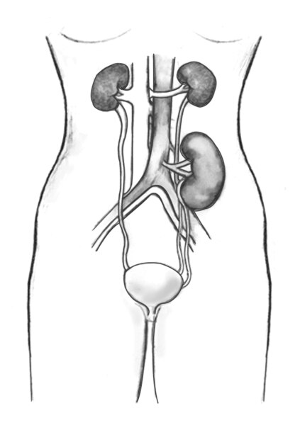 Outline of a female figure with a transplanted kidney.