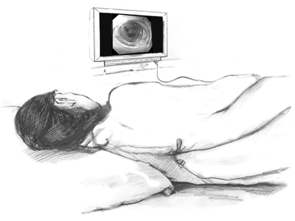 Drawing of a female patient lying on a table with an inserted sigmoidoscope projecting an image onto a computer screen.