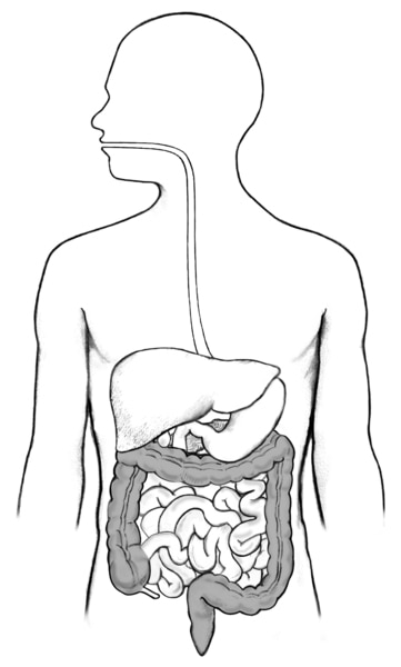Drawing of the digestive tract within an outline of the human body. The stomach, small intestine, large intestine, rectum, and anus not labeled.