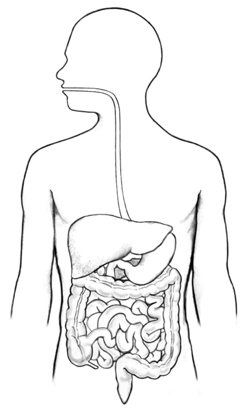 Drawing of the digestive tract within an outline of the human body. The mouth, esophagus, stomach, duodenum, small intestine, and anus not labeled.
