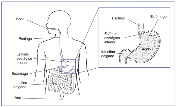 Ilustración del tracto digestivo dentro de un perfil de la mitad superior de un cuerpo humano. El recuadro muestra un corte transversal del estómago.