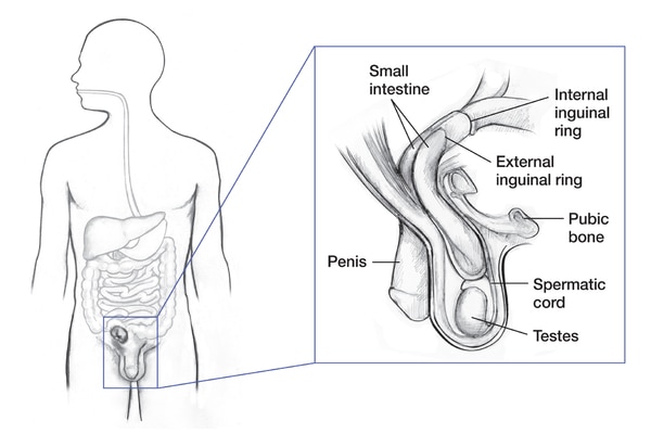 Anatomy of the inguinal canal and its sur r ounding str uctur es 10 |  Download Scientific Diagram