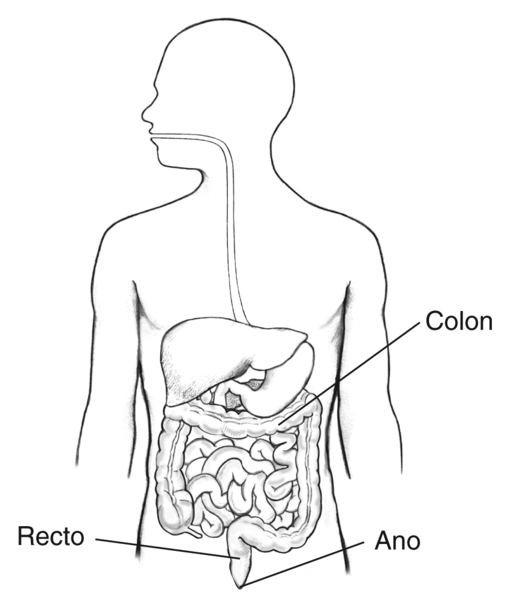 Ilustración del tracto digestivo dentro de un perfil de la mitad superior de un cuerpo humano. Están marcados el colon, recto y ano.