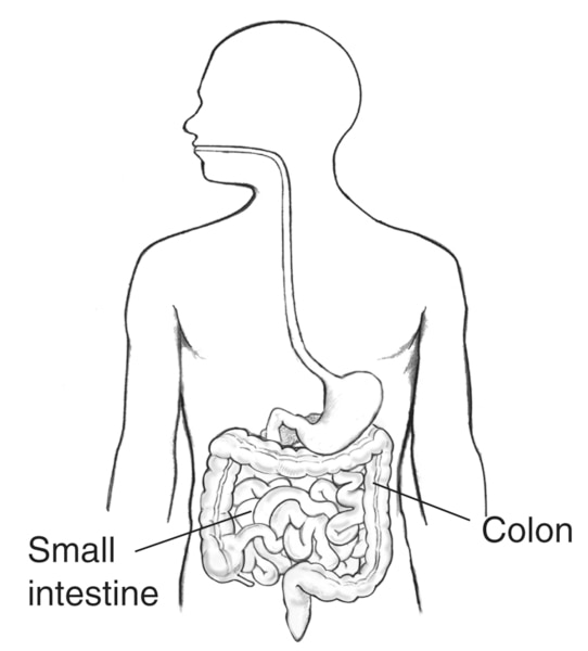 Drawing of the digestive tract within outline of male body, with labels pointing to the small intestine and colon.