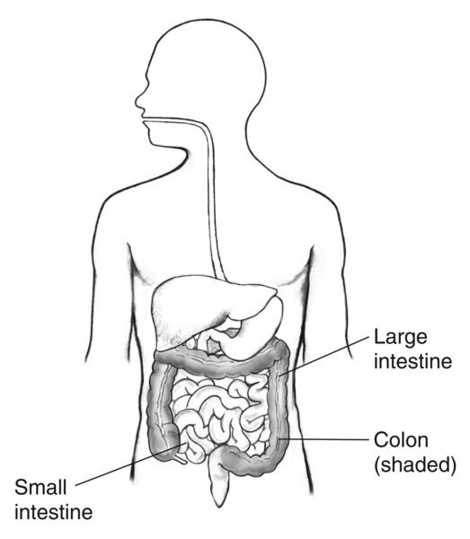 Drawing of the digestive tract within outline of male body, with labels pointing to small intestine, large intestine, and colon (shaded).