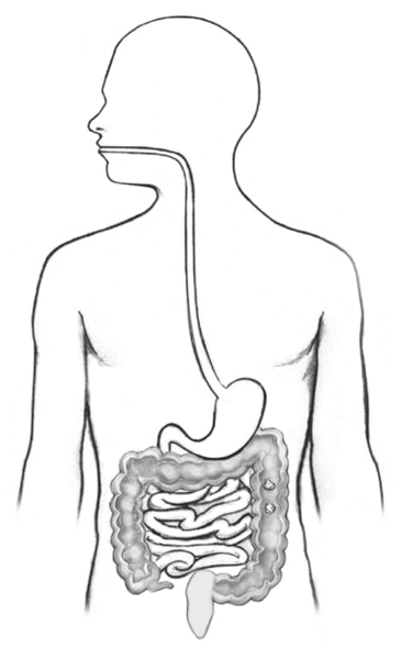 Drawing of the digestive tract within outline of the human body that includes large intestine, colon (shaded), rectum, and anus.