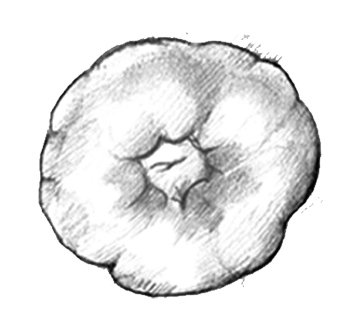 Drawing of a stoma.