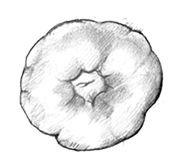 Drawing of a stoma.