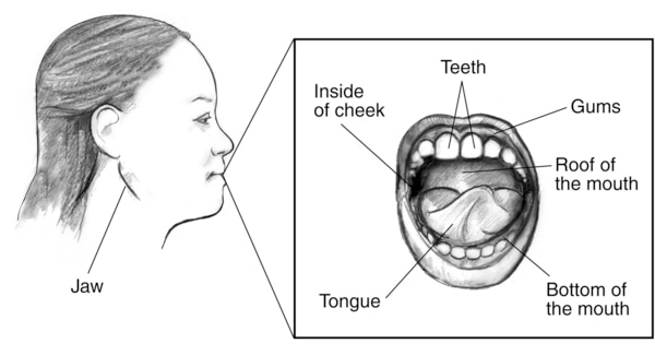 Drawing of a woman’s facial profile with the jaw labeled. Inset shows teeth, gums, roof of the mouth, bottom of the mouth, tongue, and inside of cheek.