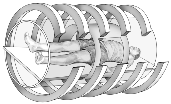Drawing of a magnetic resonance imaging machine with a male patient lying on a table inside the hollow tunnel of the machine. The MRI magnets are shown as large bands that encircle the patient.