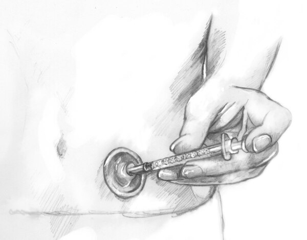Drawing of a person injecting insulin with a needle and syringe through an injection port attached to the abdomen. The port has a round adhesive patch covering a cannula inserted under the skin.