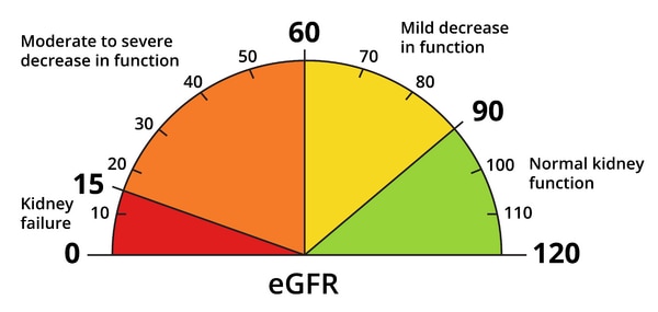 An eGFR meter showing kidney function. Less than 15 is kidney failure, 15 to 59 is moderate to severe decrease in function, 60 to 89 is mild decrease in function, and 90 to 120 is normal kidney function.