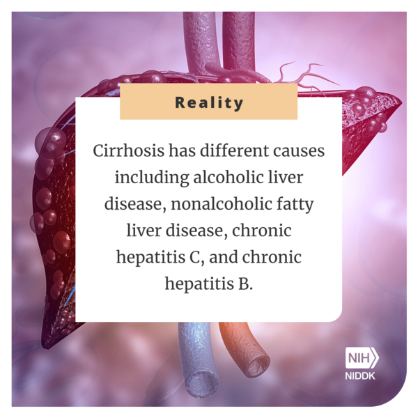 Reality: Cirrhosis has different causes including alcoholic liver disease, nonalcoholic fatty liver disease, chronic hepatitis C, and chronic hepatitis B.