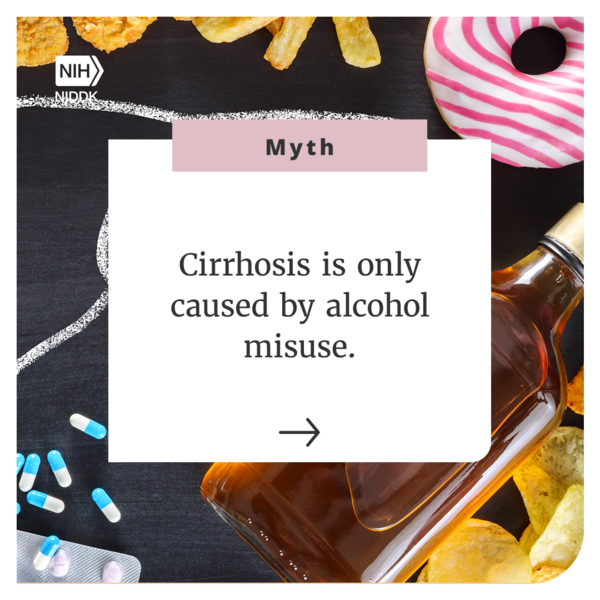 Myth: Cirrhosis is only caused by alcohol misuse.