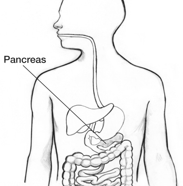 Drawing of a body torso showing the pancreas and part of the digestive system, with the pancreas labeled.