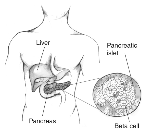 Drawing of a male torso showing the location of the liver and the pancreas labeled with an enlargement of a pancreatic islet containing beta cells.