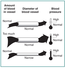 Picture of blood flowing through a normal blood vessel, blood flowing through a narrowed blood vessel, and too much blood flowing through a normal blood vessel.